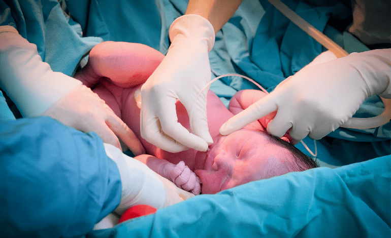 Atención de Nacimiento por Cesárea con el Ginecólogo y Obstetra Dr. Eduardo Gutiérrez Orozco en Monterrey