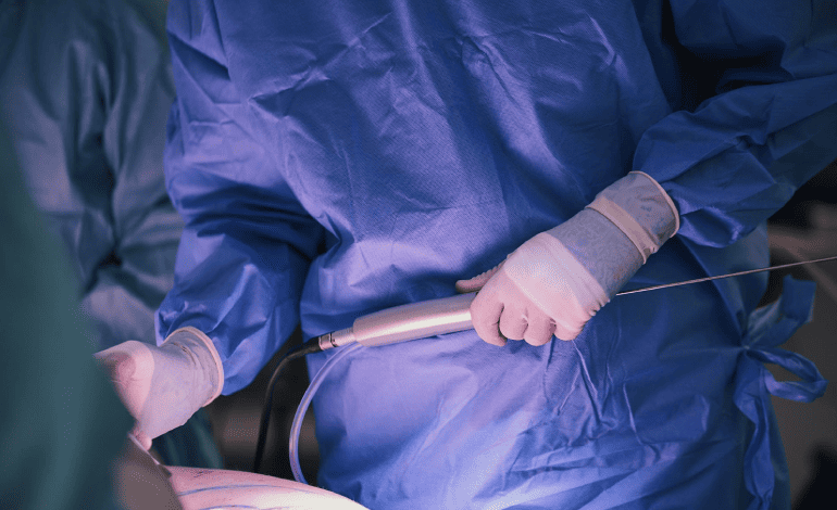 Miomectomía por Histeroscopia con el Ginecólogo y Obstetra Dr. Eduardo Gutiérrez Orozco en Monterrey