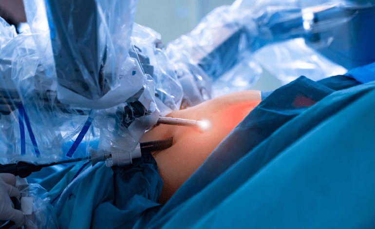 Miomectomía por Laparoscopia con el Ginecólogo y Obstetra Dr. Eduardo Gutiérrez Orozco en Monterrey