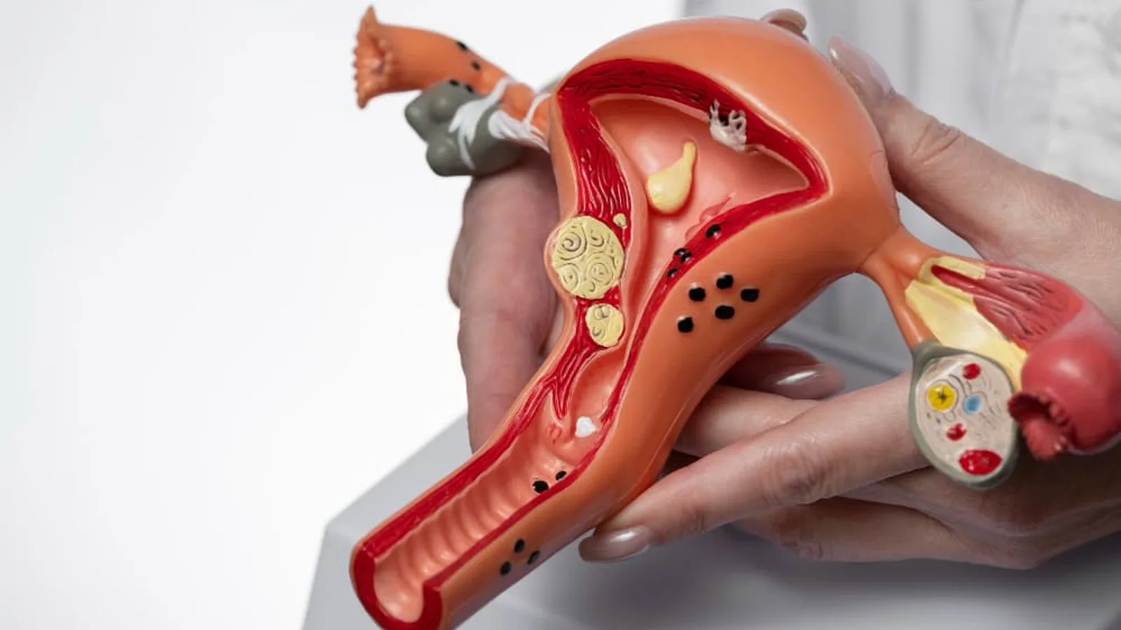 Especialista en Diagnóstico y Tratamiento de Infecciones Vaginales en Monterrey